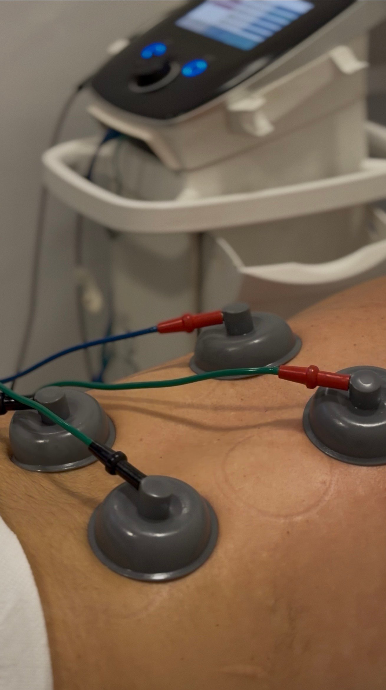 Elektro Terapia